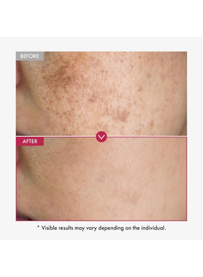 KOEC Niacinamide 10% + TXA 4% Serum 30ml, for Sensitive skin, Korean Glass Skin, Fragrance-Free - Image 5